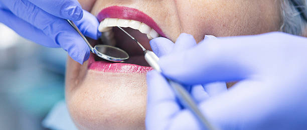 Best Knocked-Out Tooth Emergency  in Bonita, CA